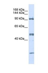 NBP1-57212 - AARS